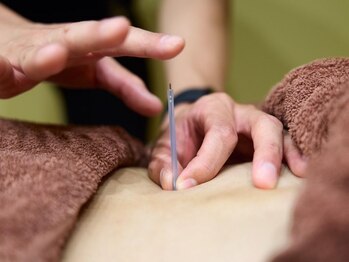 ティータートッター鍼灸院(TEETER TOTTER鍼灸院)の写真/生活の質をUPさせたい方へ♪自分の身体を知り、不調の原因を見つけ、改善ができます☆