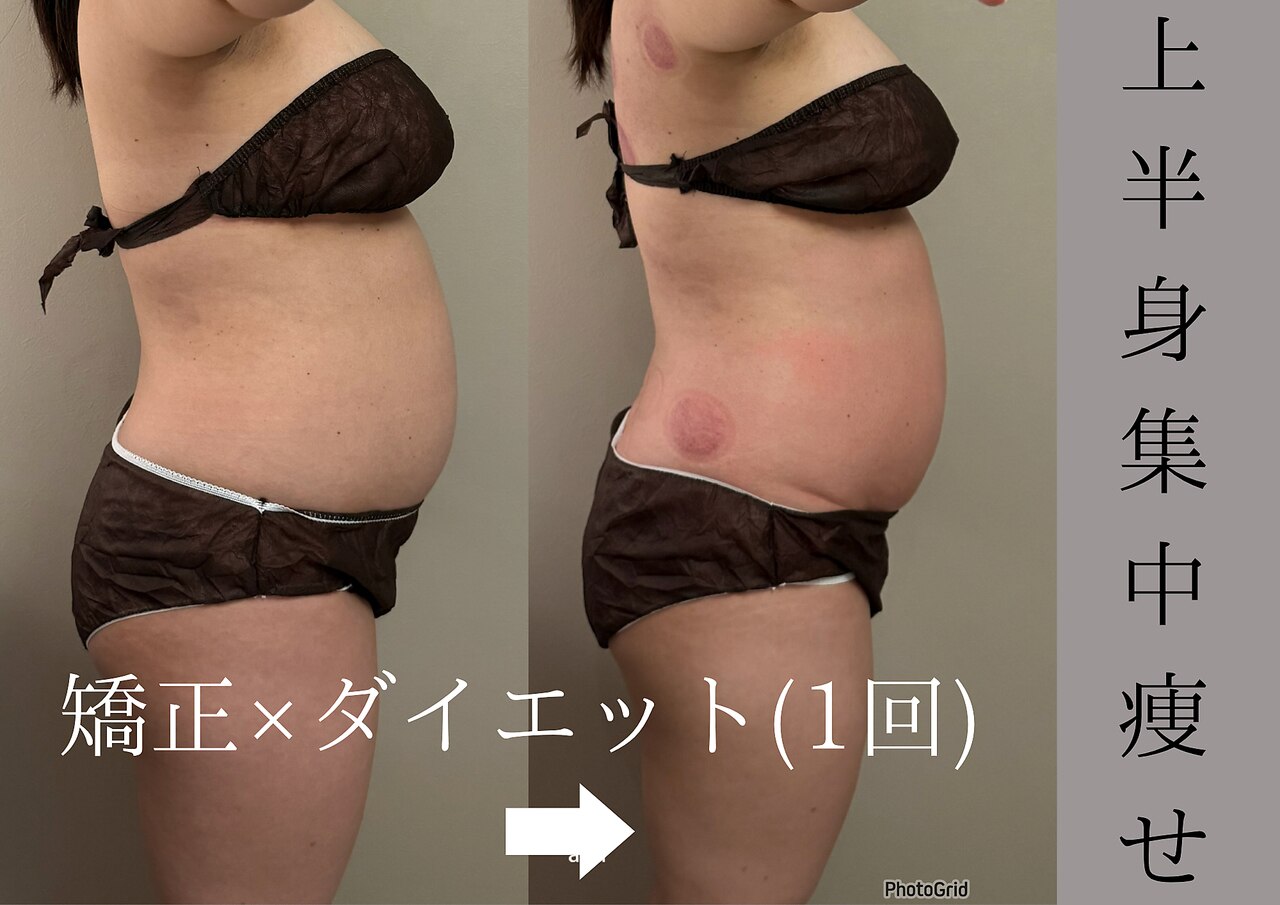 美容整骨サロン リペア(Repair)｜ホットペッパービューティー