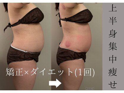 美容整骨サロン リペア(Repair)の写真