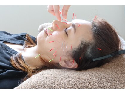 スポーツと小顔美容鍼のフジオカ鍼灸接骨院~肩こり・腰痛~の写真