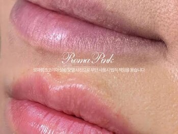 アンジェロ(Angelo)/ローマピンク施術【唇】