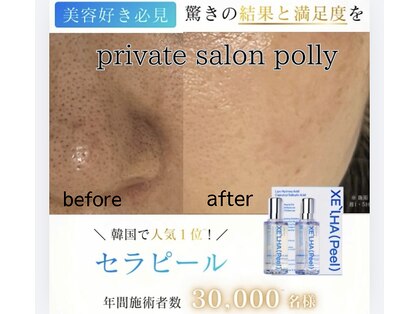 ポリー(Polly)の写真