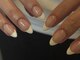 ウル ネイル(uru nail)の写真