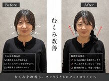 美整庵 谷山店(BISEIAN)の雰囲気（猫背・巻き肩を改善｜見た目が変わる姿勢矯正）