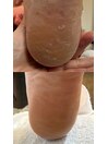 かかとふわふわ角質フットケア