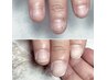 【ハンド】深爪・噛爪で悩んでいる方へ☆深爪カウンセリング(30分)