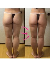 ピアリーノ(Pialino)/