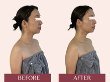 アンリール(Anrire)/【板橋/フェイシャルエステ】