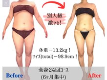 マリス(MARISS)/痩身モニター24回【痩身/小顔】