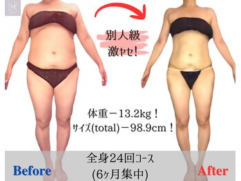 マリス(MARISS)/痩身モニター24回【痩身/小顔】