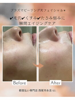 アンドエス(&S.)/綺麗な肌で年末を迎えましょ♪