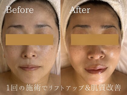 ビ フェイス(Bi-face)の写真