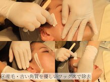 コモレビ(komorebi)/2．施術の流れをご案内♪