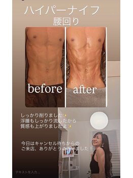 ジーニー(Genie)/痩身が大人気
