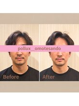 ポルクス鍼灸整骨院 表参道(Pollux鍼灸整骨院)/鍼灸　整体　美容鍼灸