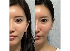 品川区で脱毛が人気のエステサロン｜ホットペッパービューティー