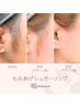 【もみあげ】シュガーリング脱毛