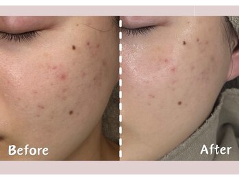 シー センター北(sii)/乾燥知らずのしっとり肌へ