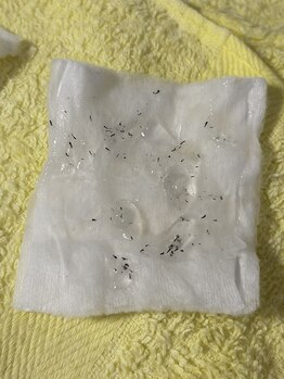 ファスモ(FASMO)/施術後の抜け感がこれ