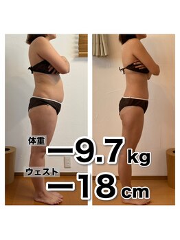 ラクエ/ビフォーアフター