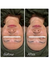 トータルビューティー雅/たった1回でこのツヤと小顔効果