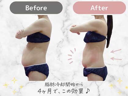 ミネット(minette)の写真