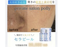 ポリー(Polly)の雰囲気(毛穴 ニキビ/ララピール進化版のセラピール!毛穴洗浄×LDM¥8800)