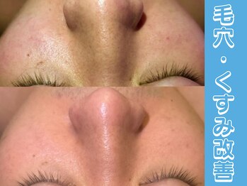 ポラリス(Polaris)/