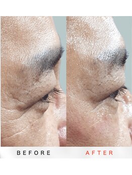 エム(M)/ララピール