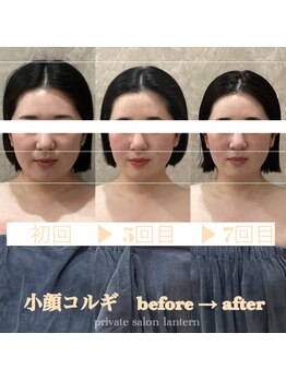 ランタン(Lantern)/小顔コルギ