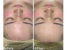 アイティス(Salon Its)/【Before &After】