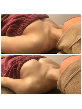 ロココ 豊田店(Rococo)/ビフォーアフター