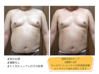 痩身 脱毛専門サロン 椿/脂肪冷却/キャビ/ラジオ波