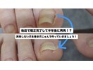 再発しない巻き爪矯正
