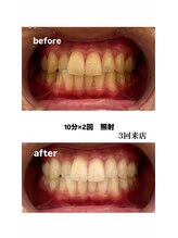エム(M)/症例写真
