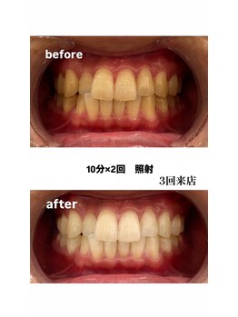 エム(M)/症例写真
