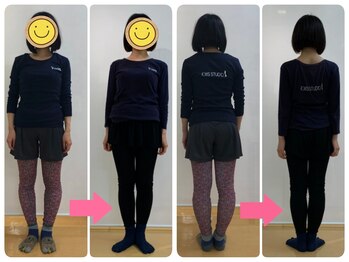 KWS股関節ウォーキングスタジオ/【4】子宮内膜症改善(20代・OL)