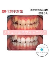 ホワイトニングジム 千葉駅前店&nbsp;WG千葉店 スタッフ