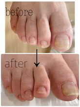 サロン マリス(salon Mariss)/フットケア