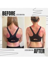 アイラッシュサロン ドール(Doll)/【全身コース】セルクラ