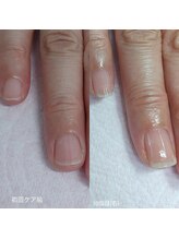 エヌプラス(Nplus)/美爪育成３ヵ月コース