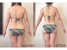 レナトゥス 銀座(Renatus)/大幅減量マイナス15kg☆【痩身】