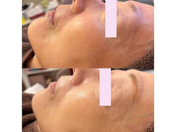 ベル(BELLE)/たるみ、シワケアはエンビロン♪