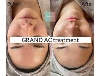 サザンベル 石垣店(SOUTHERN BELLE)/グランACトリートメント