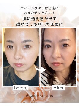 エミニナル(EMININAL)/【フェイシャル】変化