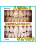 【人気No.1★お試しホワイトニング2回】20分×2回の40分照射￥6,600→¥1,980