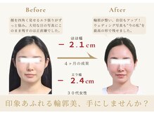 アロハ(ALOHA.)/印象を変える輪郭、手にしない？