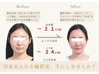 アロハ(ALOHA.)/印象を変える輪郭、手にしない?