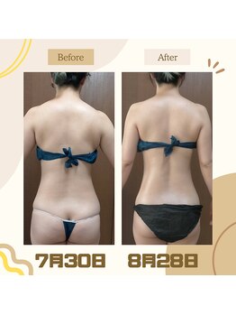 痩身 脱毛専門サロン 椿/肌ファス/やり過ぎ肌リセット7日