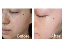 ファスール(Hwasoeur)の雰囲気（【ニキビ・跡・毛穴・くすみ】繰り返しニキビを根本改善!）